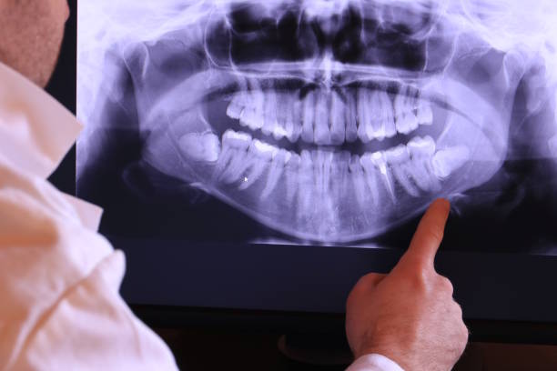 Best Emergency Dental Extractions in Sylvan Lake, MI