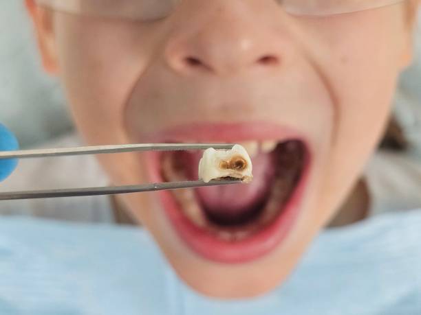Best Mobile Emergency Dentist in Sylvan Lake, MI
